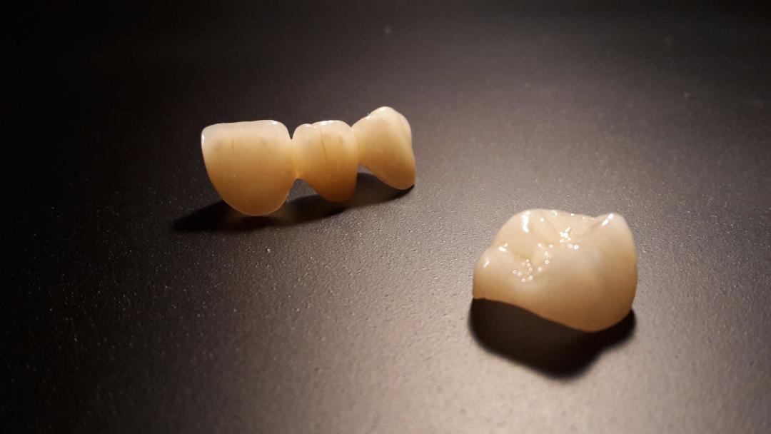 Ceramic-Dental-Crown